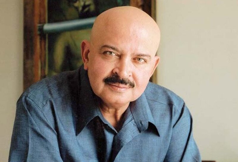 Why does Rakesh Roshan have no hair on his head?
